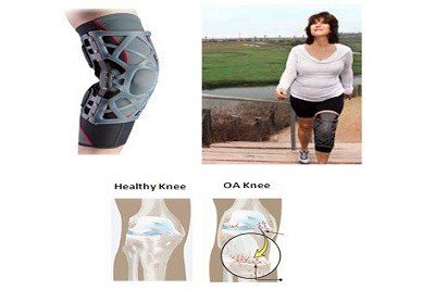 OSTEO ARTHRITIS (OA)